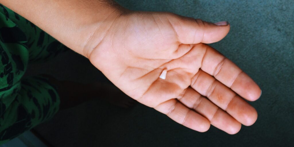 Hand holding a broken piece of tooth in Thornhill