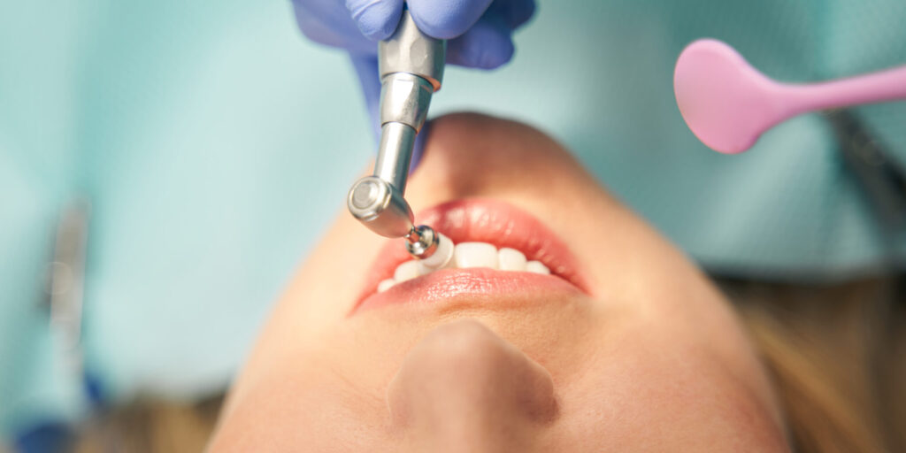 Teeth cleaning procedure in London practice.