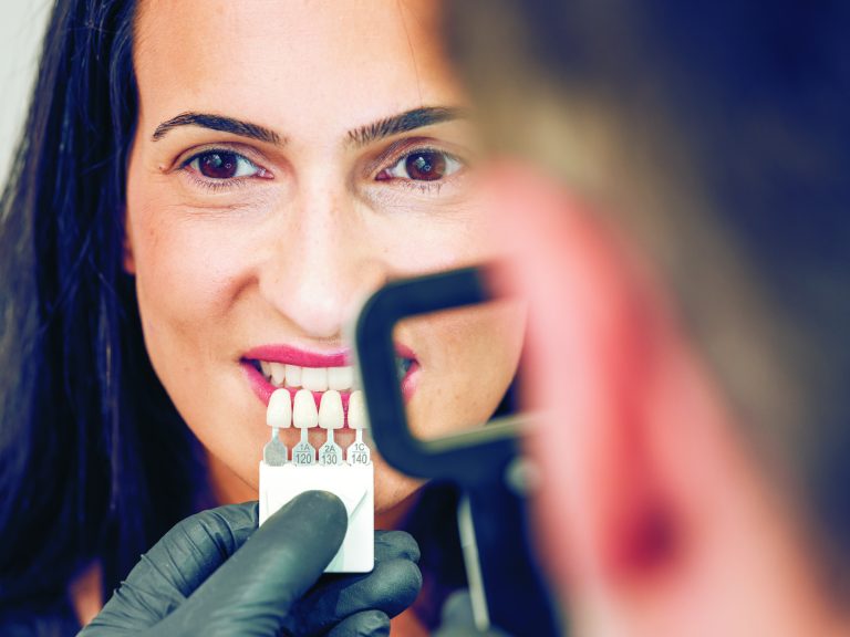 Dental Sealants: Why Your Markham Dental Clinic Suggests Them