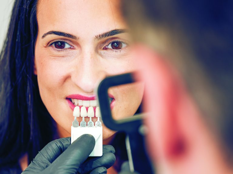 Why Dental Bonding in Markham Is Perfect for First-Time Smiles